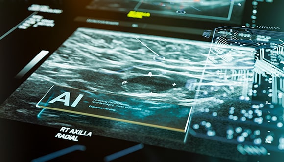 AI technology in healthcare