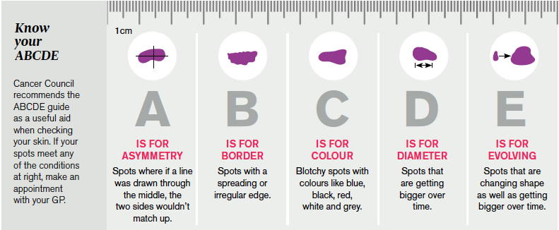 The skin cancer ABCDE table