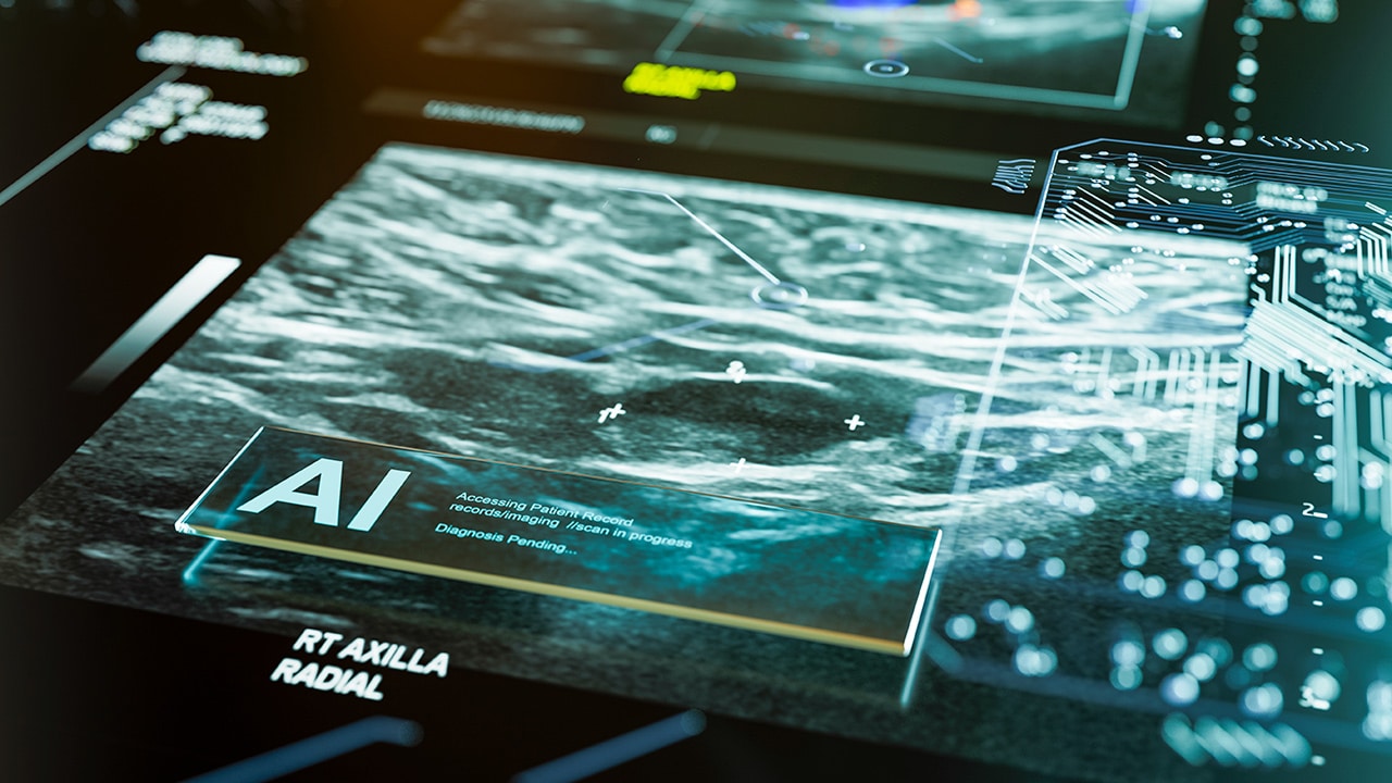 An x-ray image of a radial axilla.